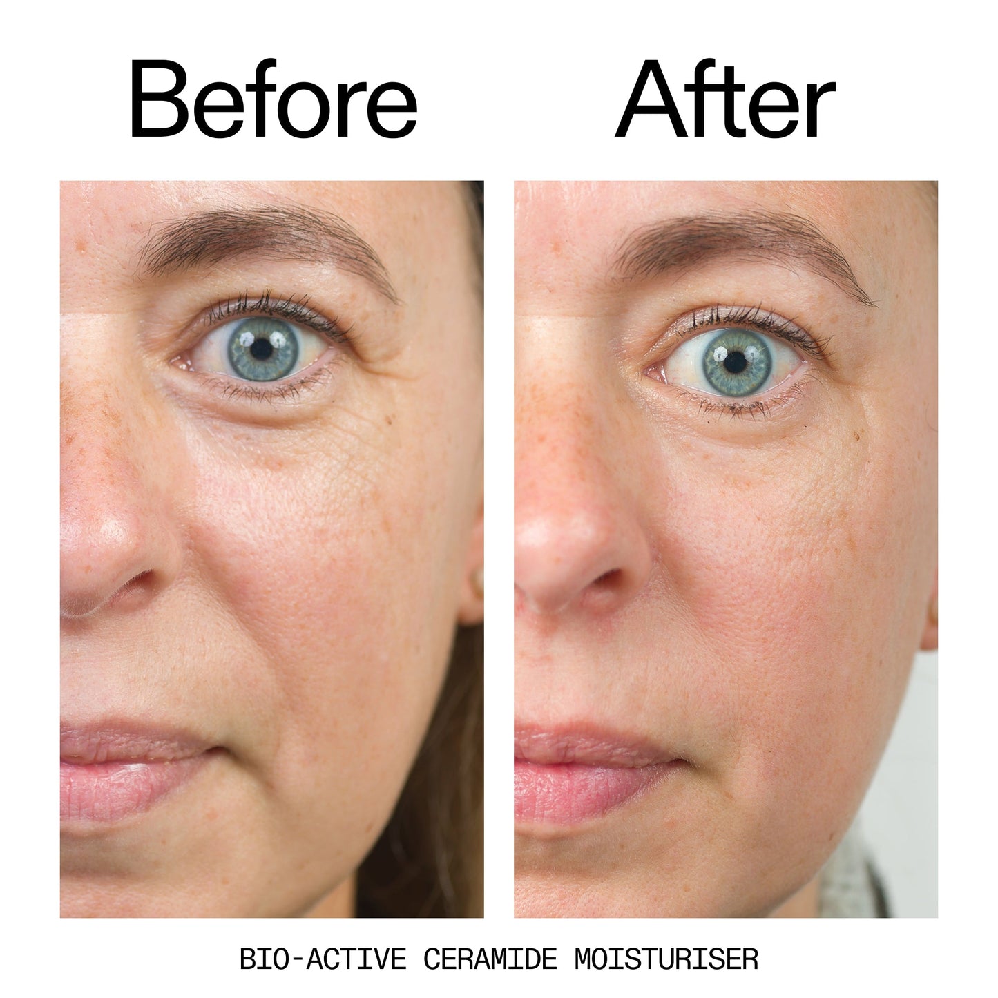 barrier-boosting-trio-u5 Bio-Active_Before_After_2000x2000_600947b4-e8c5-425a-9155-fc15bc83aa12.jpg