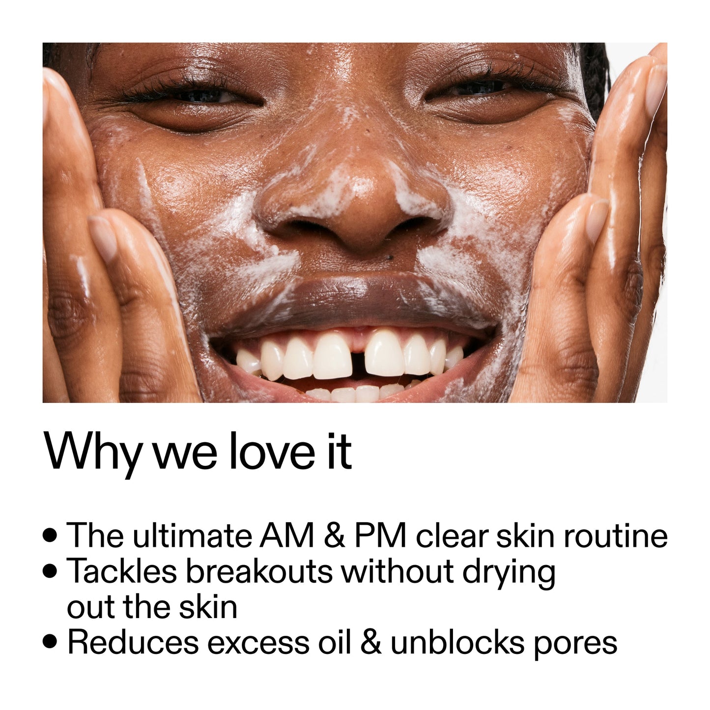 intro-routine-for-acne-m7 Intro_Routine_for_Acne_Why_we_love_it_2000x2000_42499e10-4629-4a0e-a627-7e215f4da6bc.jpg