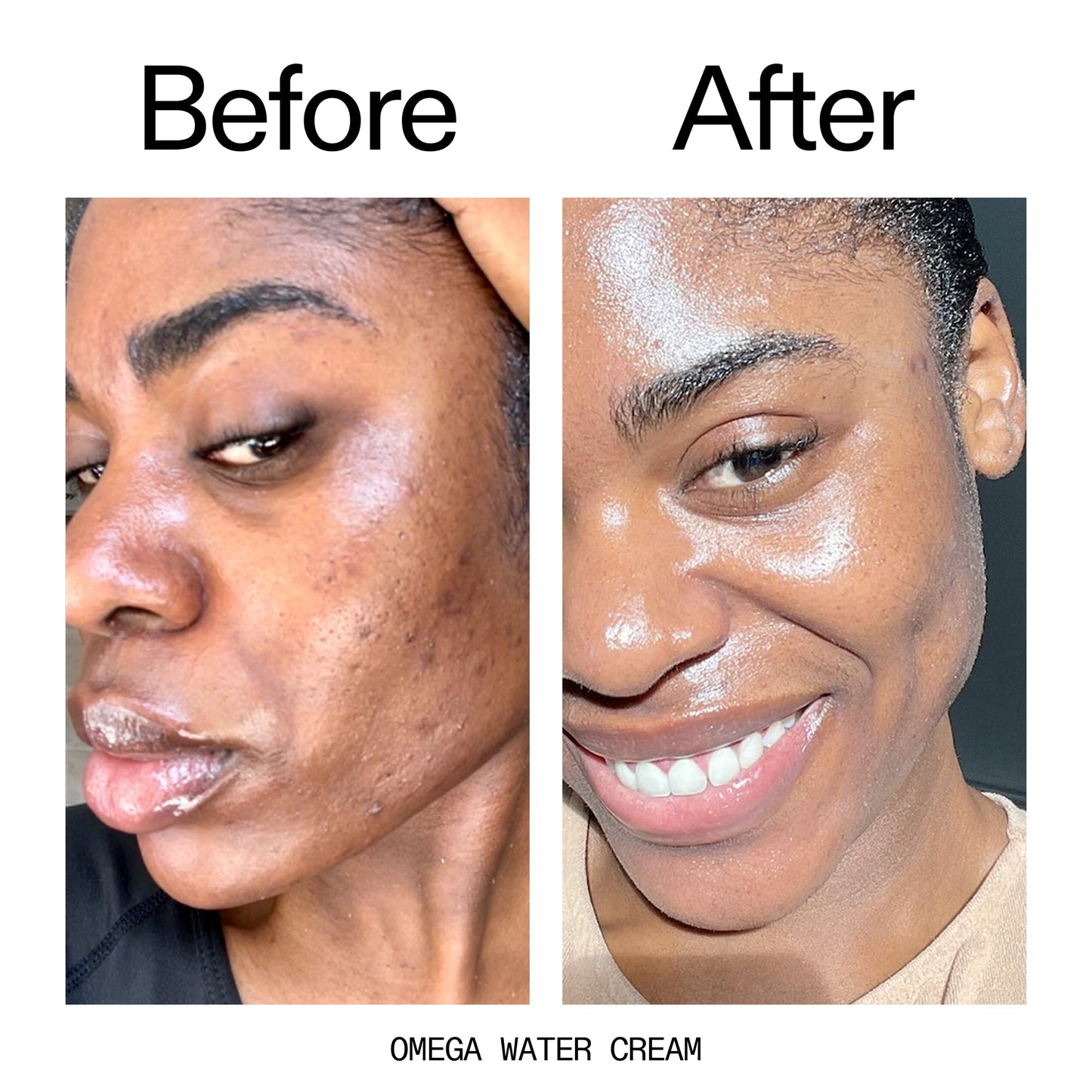 glowing-skin-set-p7 Omega_Water_Cream_Before_After_2000x2000_8e88278b-8c8d-48dc-ac77-4e98ebbd1b77.jpg