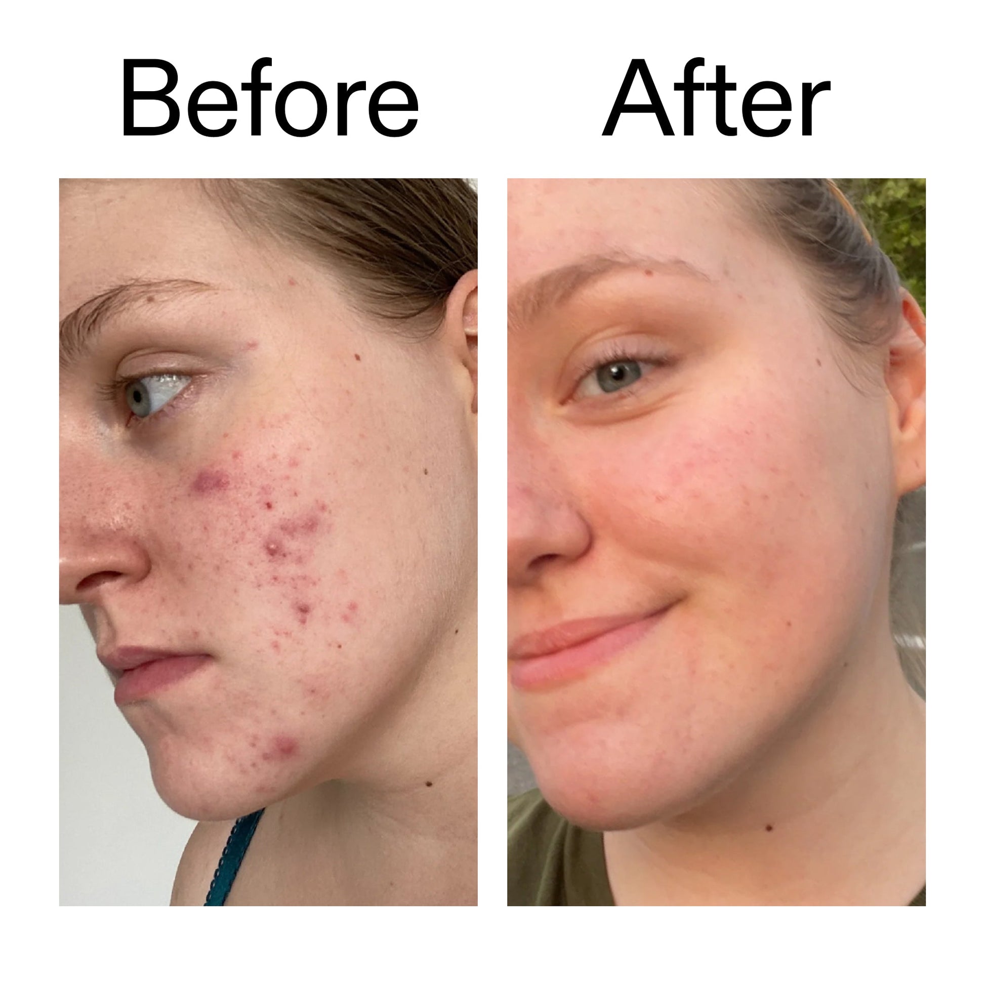 15-vitamin-c-egf-serum-z0 15_Vitamin_C_EGF_Serum_Before_After_2000x2000_fb9f598a-3386-40c8-8143-36f9d7a17ec8.jpg