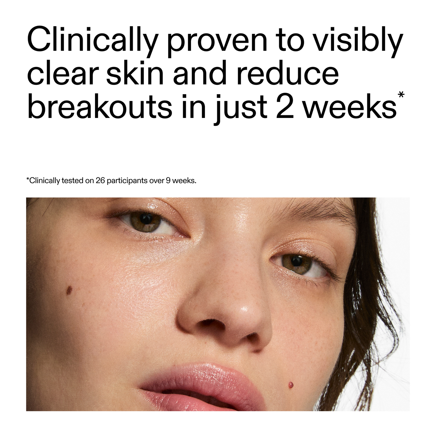 360-acne-clearing-serum-z5 360_Serum_Key_Claim.png