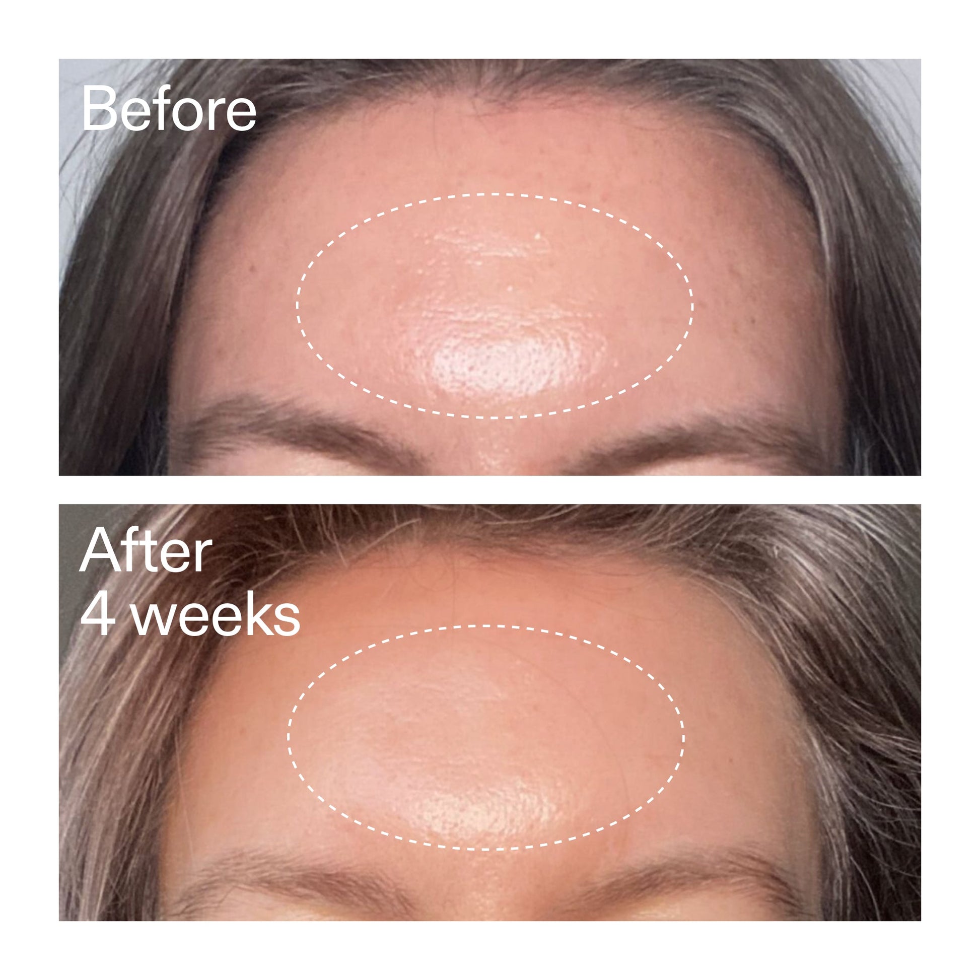 advanced-0-2-retinal-serum-i2 AdvancedRetinal_BeforeAfter1_2000x2000_1da6bb0a-29dd-41d1-95b7-8679696bbf0f.jpg