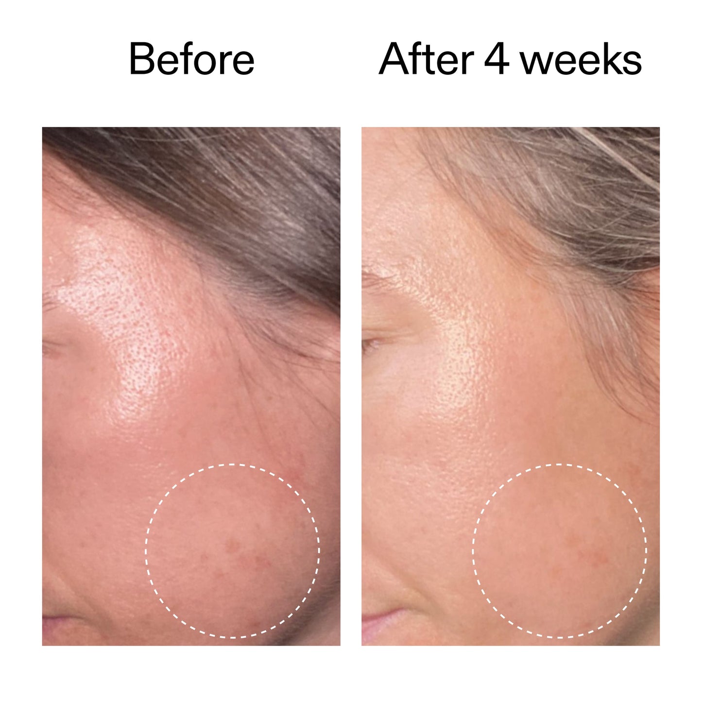 advanced-0-2-retinal-serum-i2 AdvancedRetinal_BeforeAfter2__2000x2000_62fb16bb-77ae-4d63-8500-88dbf847f4b9.jpg