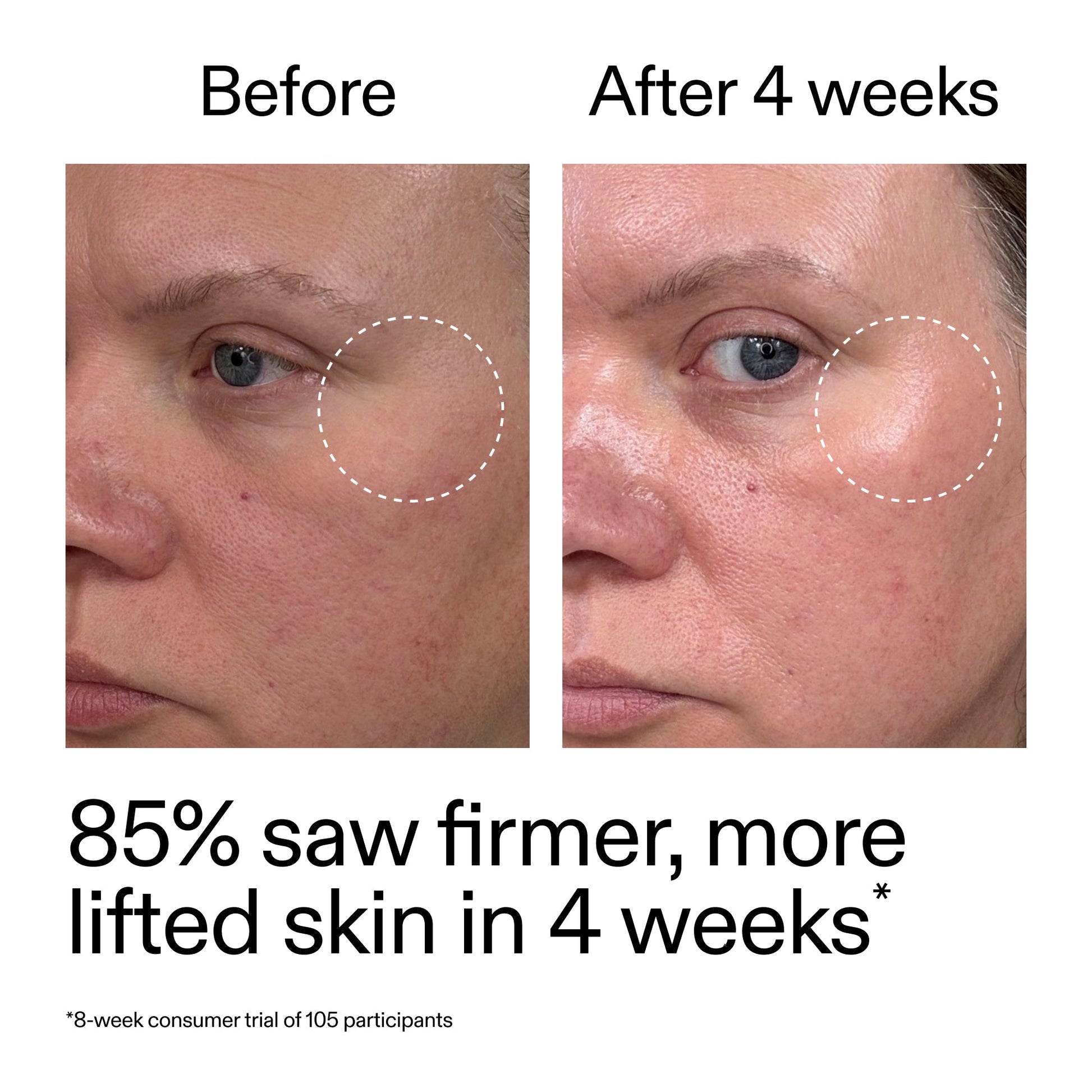 advanced-0-2-retinal-serum-i2 AdvancedRetinal_BeforeAfter_Claim1_2000x2000_bcc385c4-5e73-4f1e-aba8-64267937d0d3.jpg