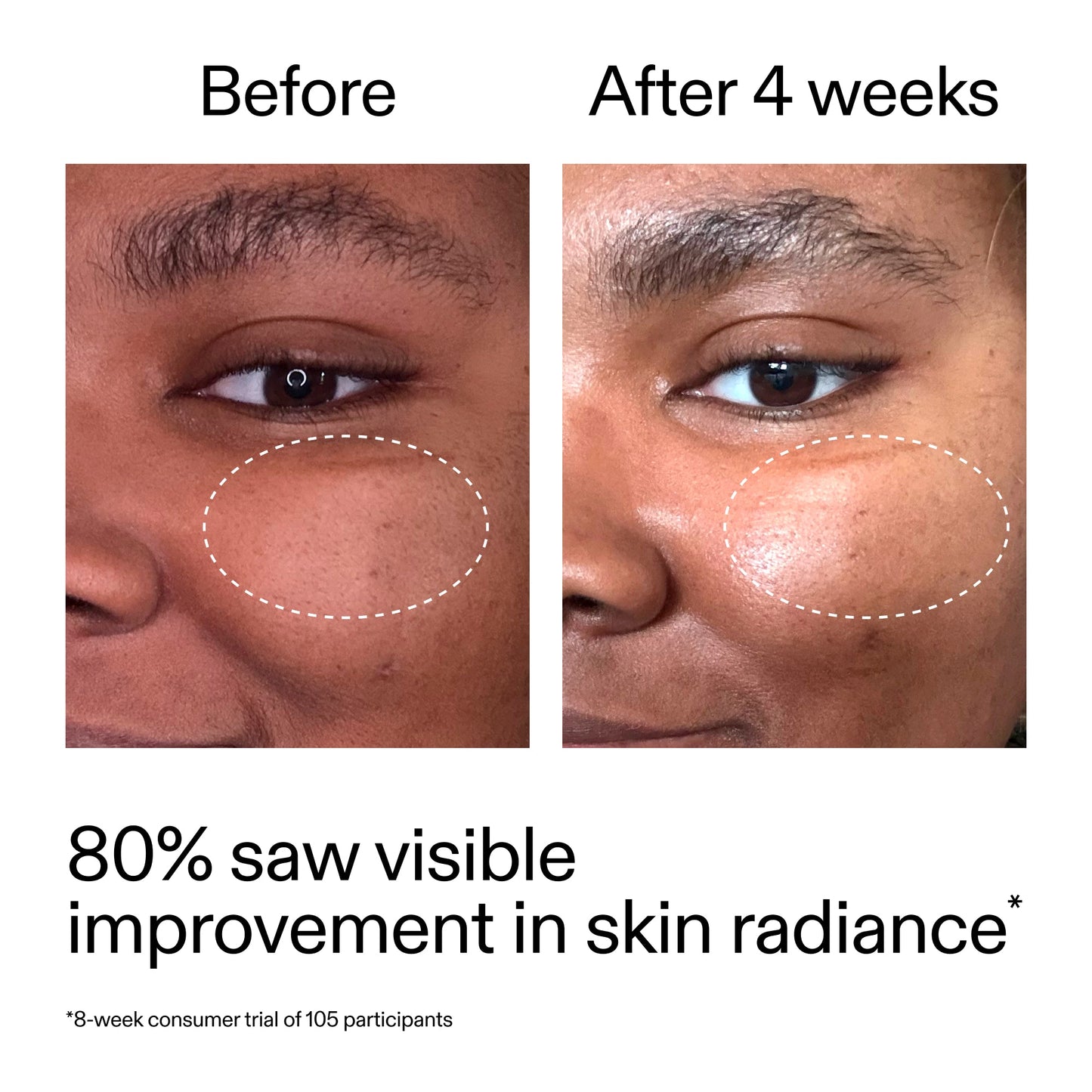 advanced-0-2-retinal-serum-i2 AdvancedRetinal_BeforeAfter_Claim2_2000x2000_39d11e3d-eda9-44ec-ab32-2903b1a368bd.jpg