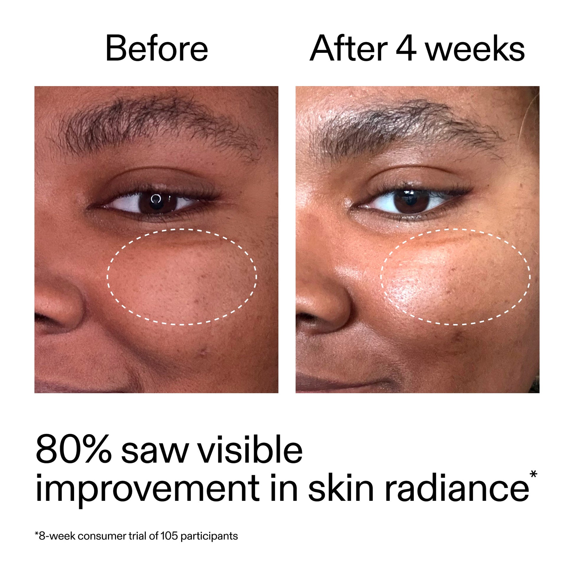advanced-0-2-retinal-serum-i2 AdvancedRetinal_BeforeAfter_Claim2_2000x2000_39d11e3d-eda9-44ec-ab32-2903b1a368bd.jpg