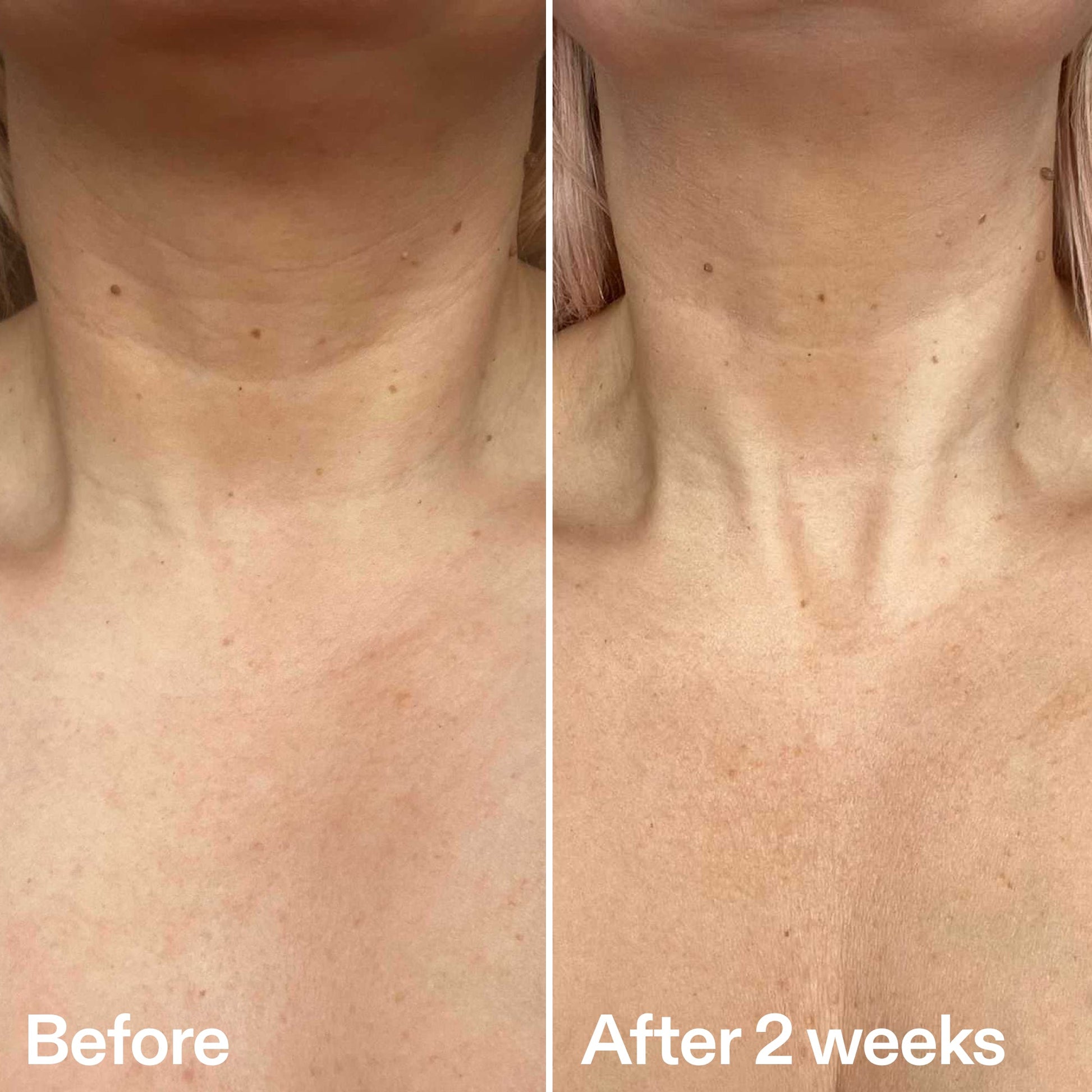 bio-active-neck-lift-stick-r5 B_A_2.jpg