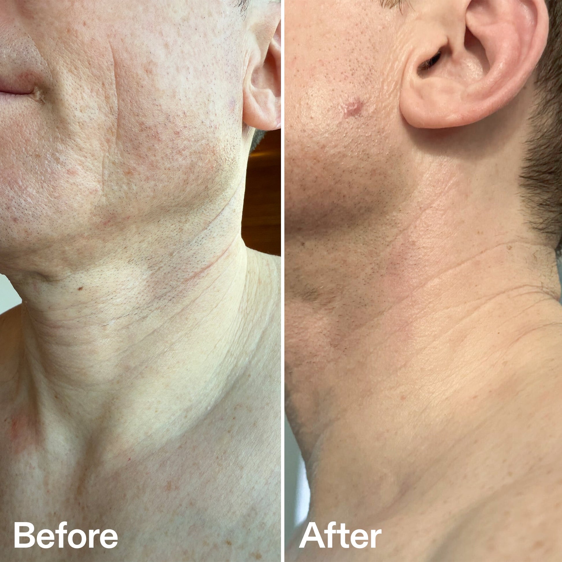 bio-active-neck-lift-stick-r5 B_A_afa2743e-b8e2-4504-92f4-e281cb6cf759.jpg