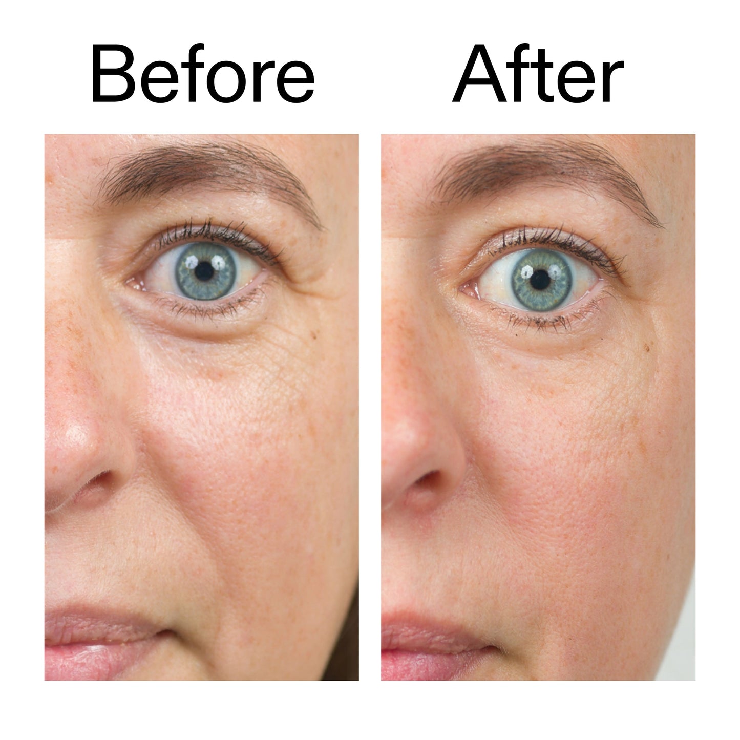 bio-active-ceramide-moisturizer-duo-g2 Bio-Active_Before_After_2000x2000_566e5a9e-135e-417a-8242-b44e5fa35463.jpg