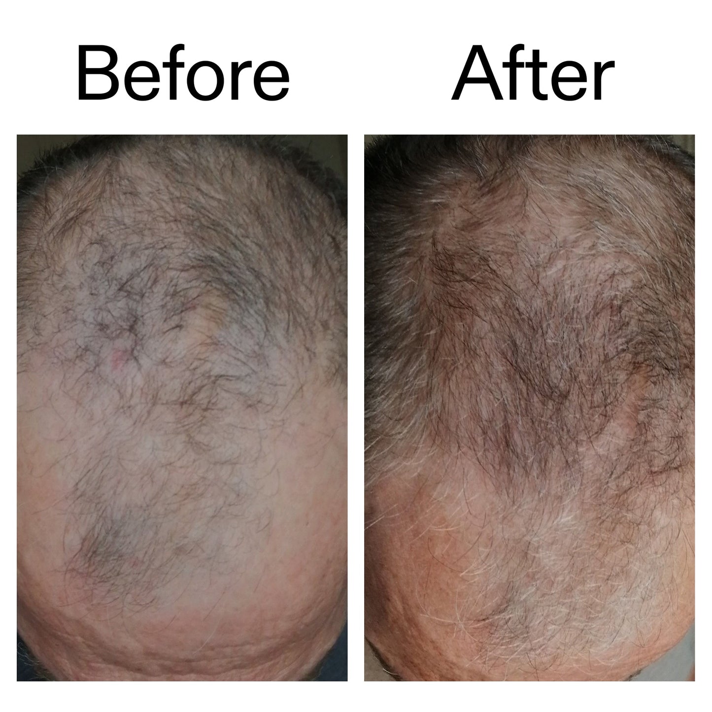 caffeine-stimulating-scalp-treatment-w9 Caffeine_Scalp_Treatment_B_A_Ppage_2000_x_2000.jpg