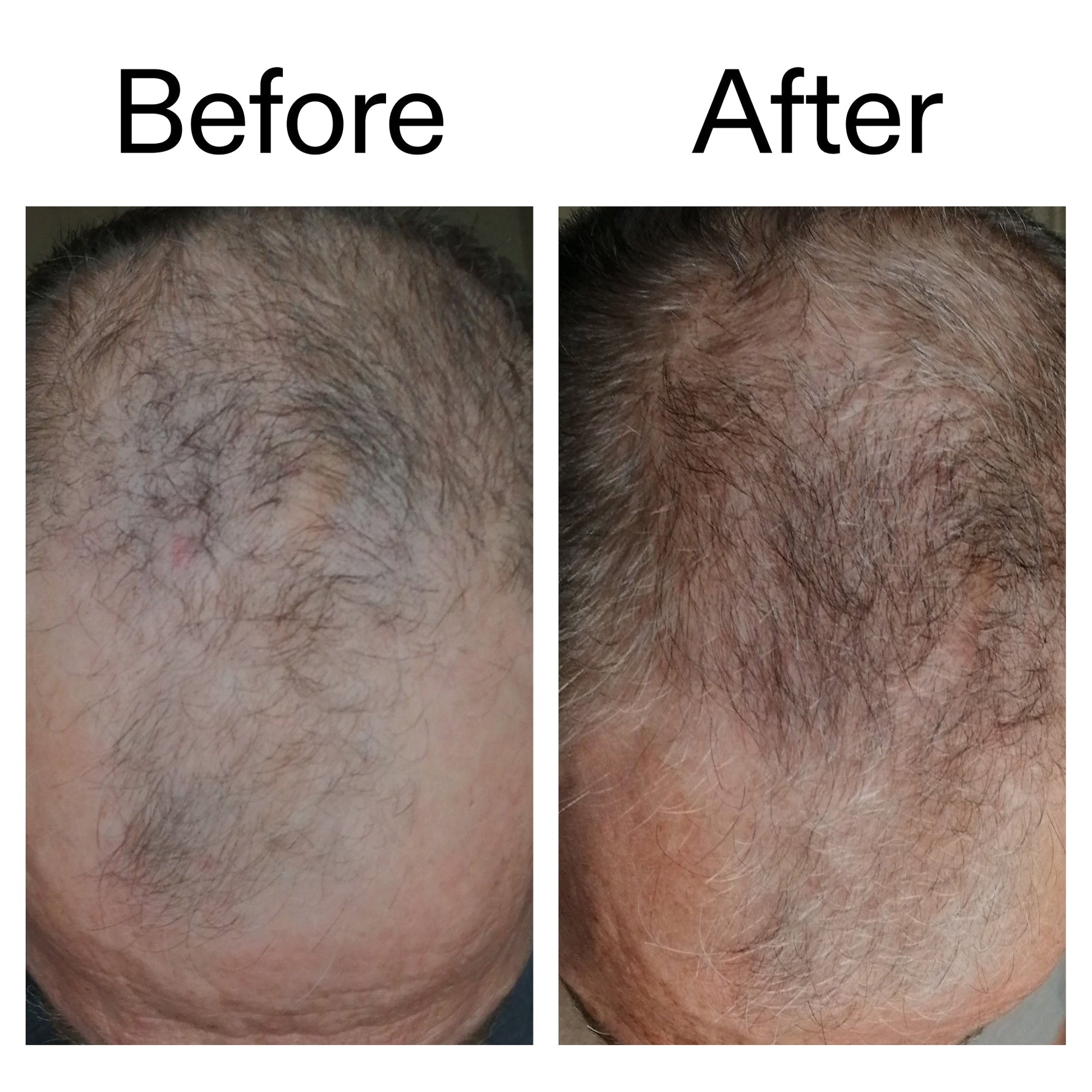3-month-hair-growth-trio-e5 Caffeine_Scalp_Treatment_B_A_Ppage_2000_x_2000.jpg