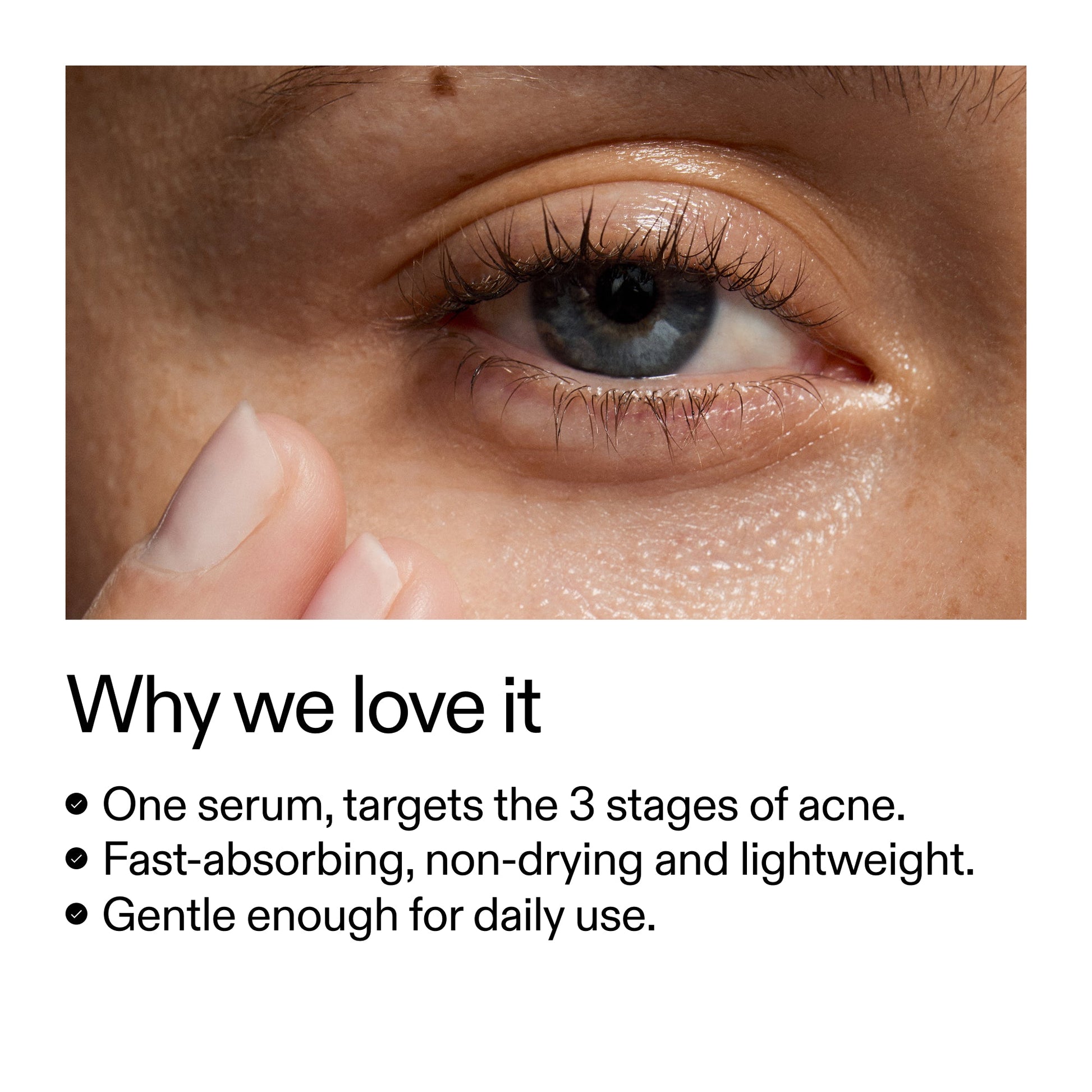 360-acne-clearing-serum-z5 Dioic_Whyweloveit_2000x2000_175aafd3-0cbe-403a-b317-a8362881bfe2.jpg