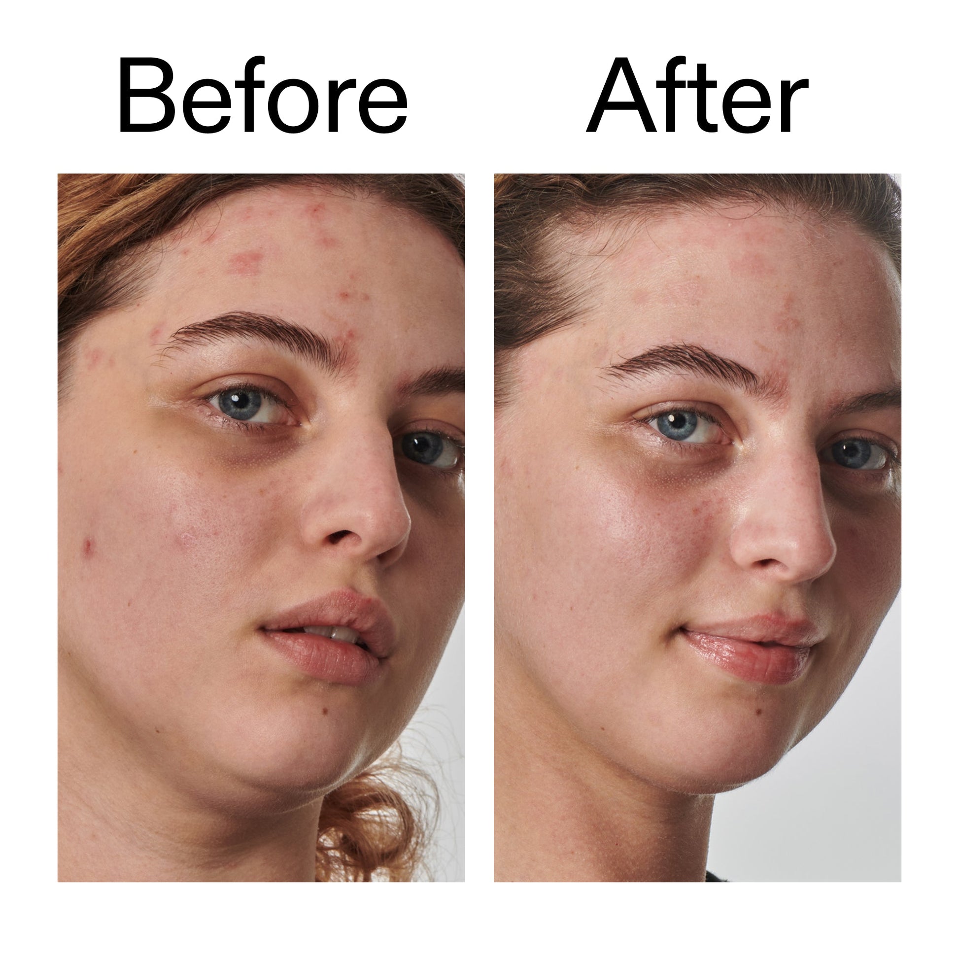 10-urea-moisturizer-t4 Dry_and_Rough_Skin_Solution_Before_After_2000x2000_efa6e639-5c39-49bd-a5dd-f0220293120a.jpg