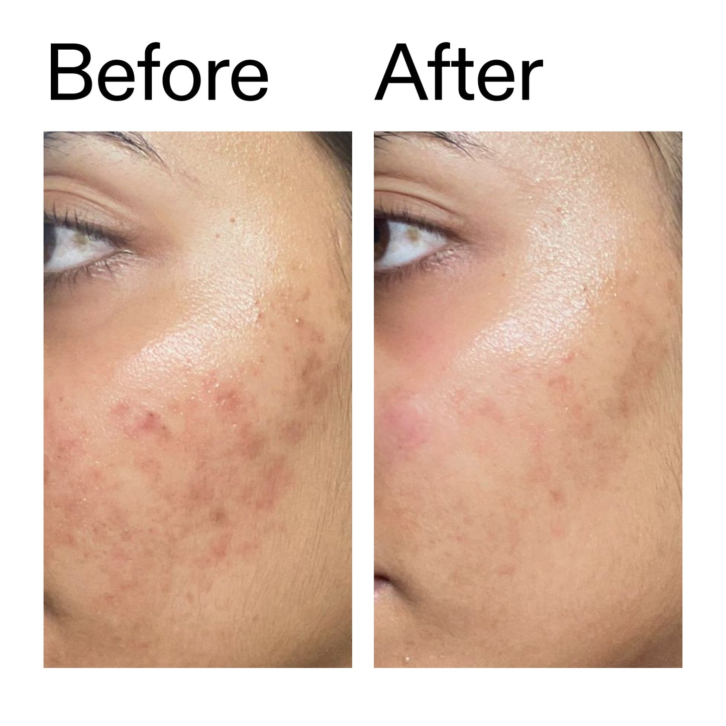 ectoin-hydro-barrier-serum-j6 Ectoin_Hydro-barrier_Serum__Before_After_2000x2000_34261920-d004-48d0-9c7b-8e1c15971bfd.jpg