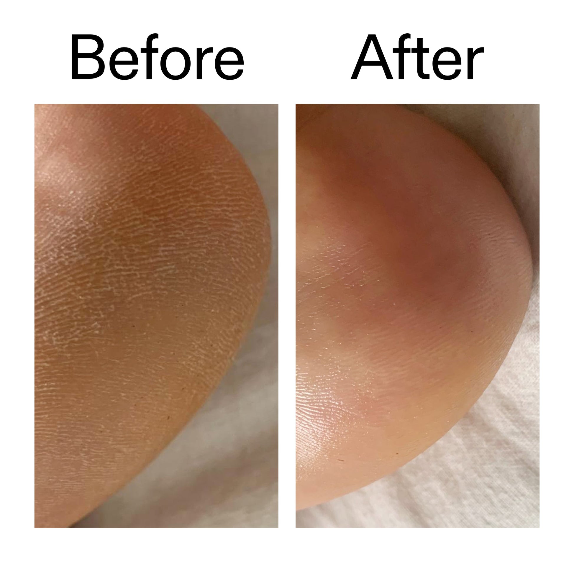 glycolic-acid-exfoliating-body-stick-l4 Glycolic_Acid_Exfoliating_Body_Stick_Before_After_V1_2000x2000_a3043625-9400-429a-a7fb-d6dbd220f722.jpg