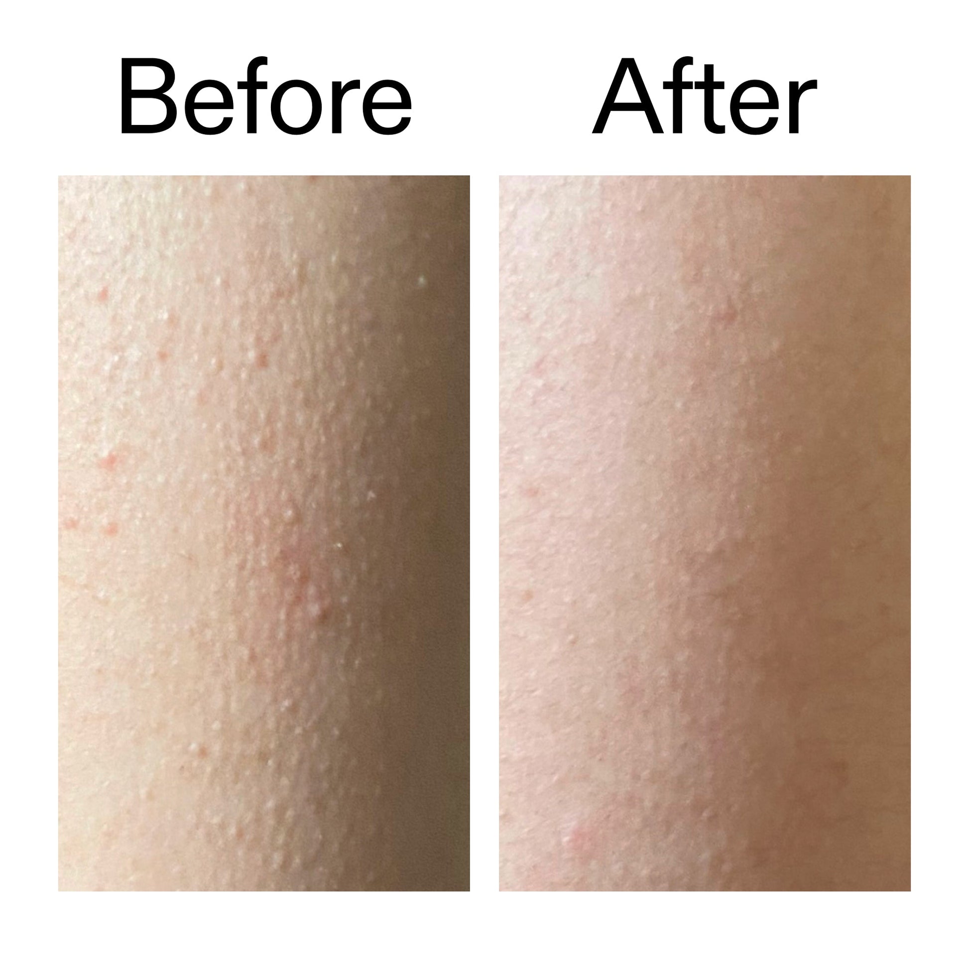 glycolic-acid-exfoliating-body-stick-l4 Glycolic_Acid_Exfoliating_Body_Stick_Before_After_V2_2000x2000_2e4ba052-94f6-4d56-82df-7bdb5b2df7ae.jpg