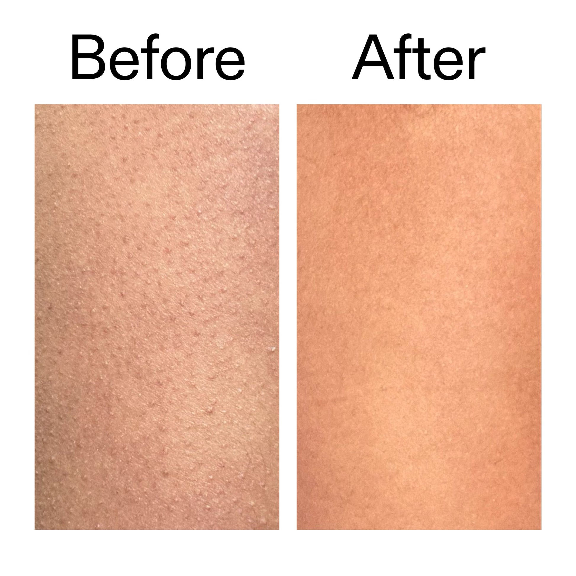 glycolic-acid-exfoliating-body-stick-l4 Glycolic_Body_Stick_B_A_2000x2000_6e6e6b4d-5bd7-43c0-aeed-4d66788e8995.jpg