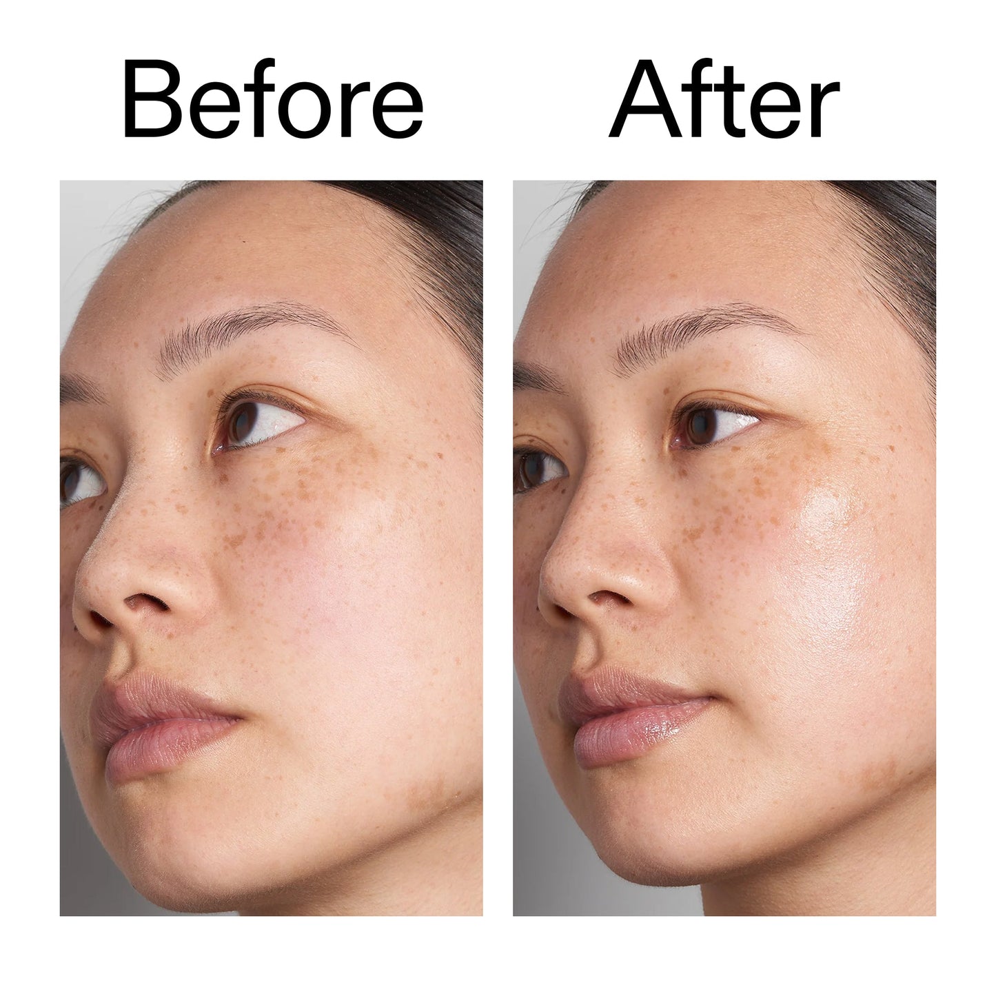 supersize-hyaluronic-acid-serum-100ml-v6 Hyaluronic_Acid_Before_After_2000x2000_d7983956-8aa2-4ea3-8255-c63e8d4f892e.jpg