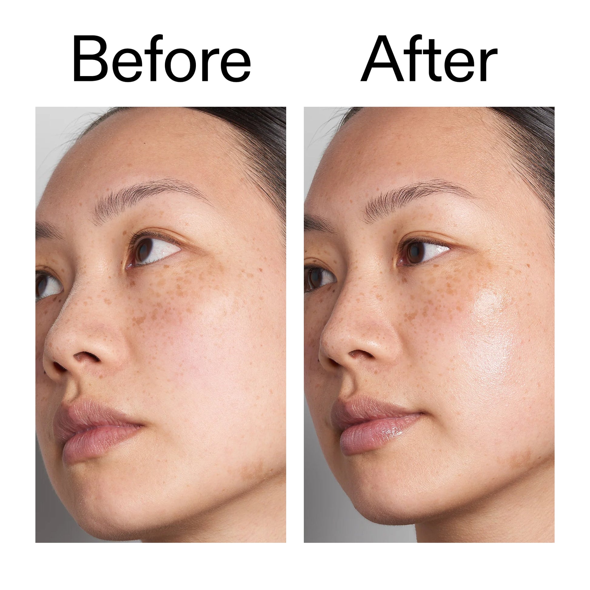 supersize-hyaluronic-acid-serum-100ml-v6 Hyaluronic_Acid_Before_After_2000x2000_d7983956-8aa2-4ea3-8255-c63e8d4f892e.jpg