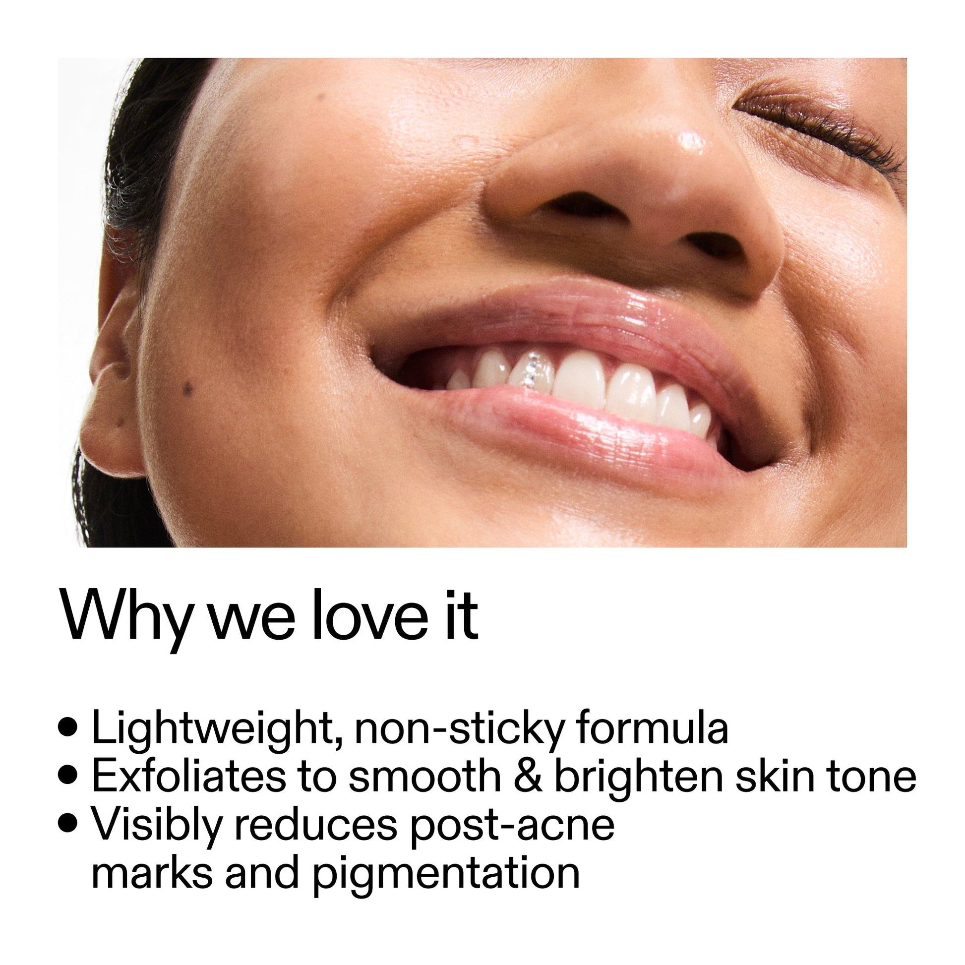 mandelic-acid-treatment-g3 Mandelic_Acid_Treatment_Why_we_love_it_2000x2000_6dfe29a9-2a79-464f-a5e8-e5ac37d93388.jpg