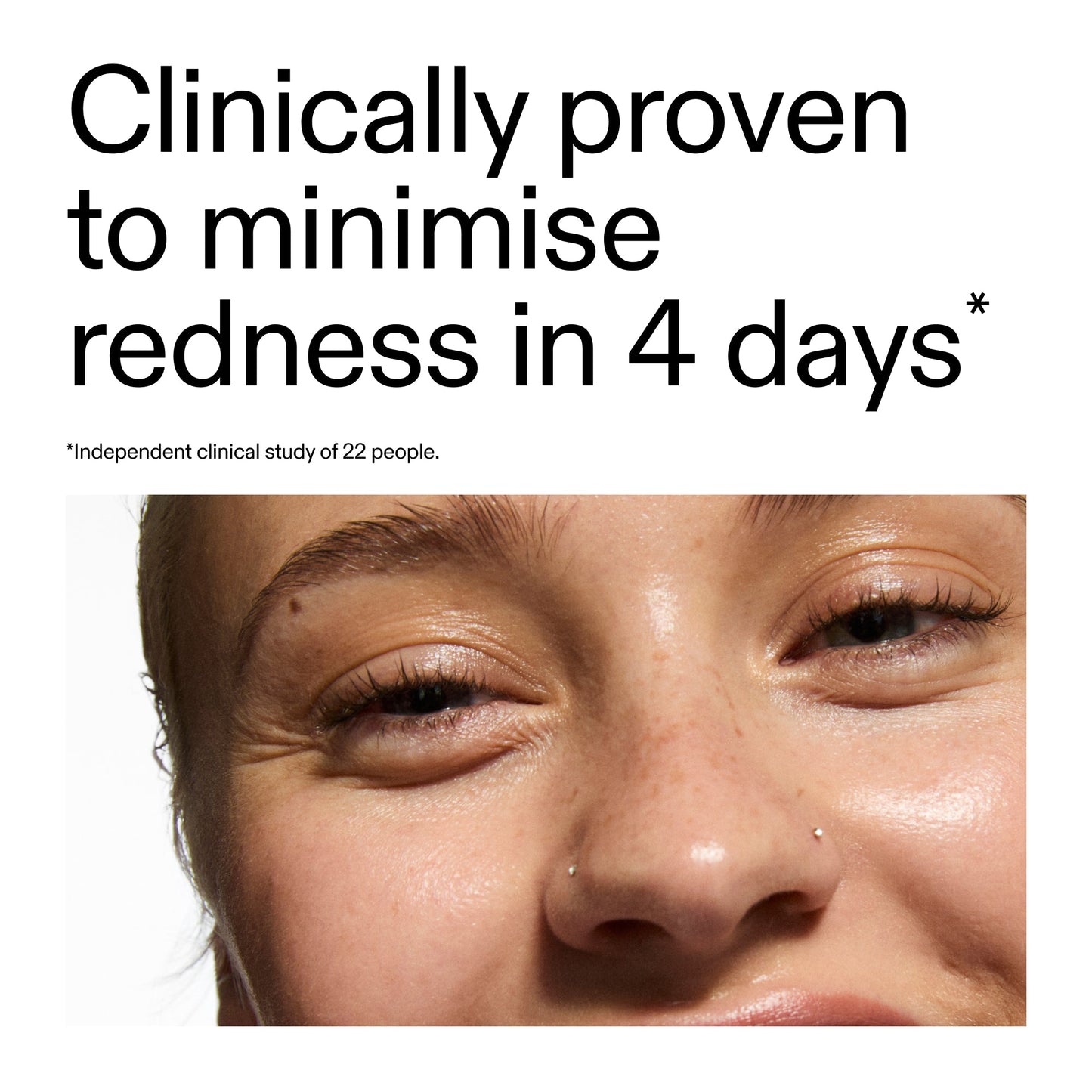 10-azelaic-acid-serum-for-redness-relief-g6 Oat_Cleansing_Balm_Claim_2000x2000_52a841dc-353c-4f2c-8646-3aadb604507d.jpg