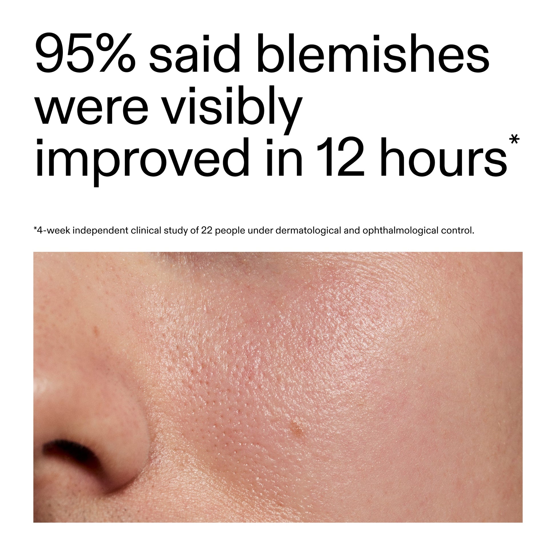 succinic-acid-acne-treatment-u9 Oat_Cleansing_Balm_Claim_2000x2000_ac6ce553-25db-41b2-a981-faae1ac4b8c0.jpg