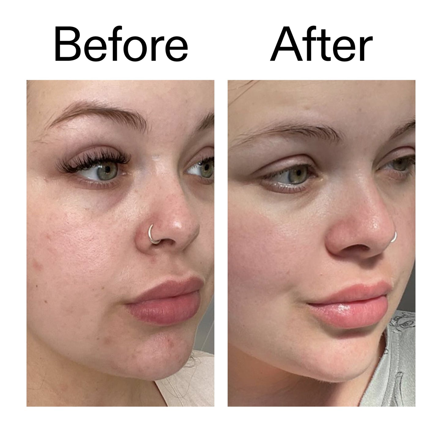 supersize-omega-water-cream-duo-r0 Omega50_Before_After_2000x2000_46483ed8-3f9d-487f-9a0c-9df79830bd65.jpg