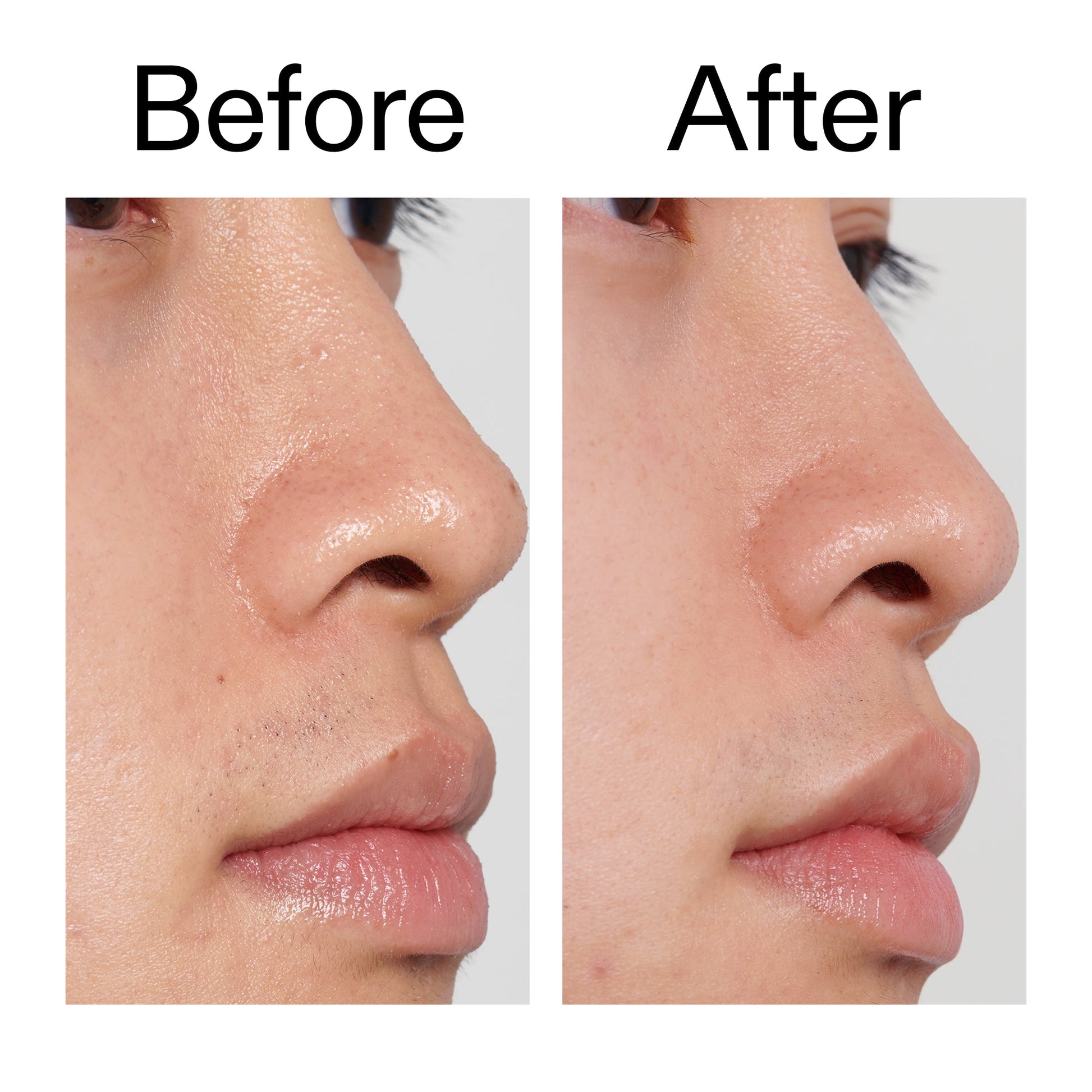 pha-toner-b9 PHA_Toner_Before_After_2000x2000_e3c10172-0150-4342-8b95-57417eaff50d.jpg