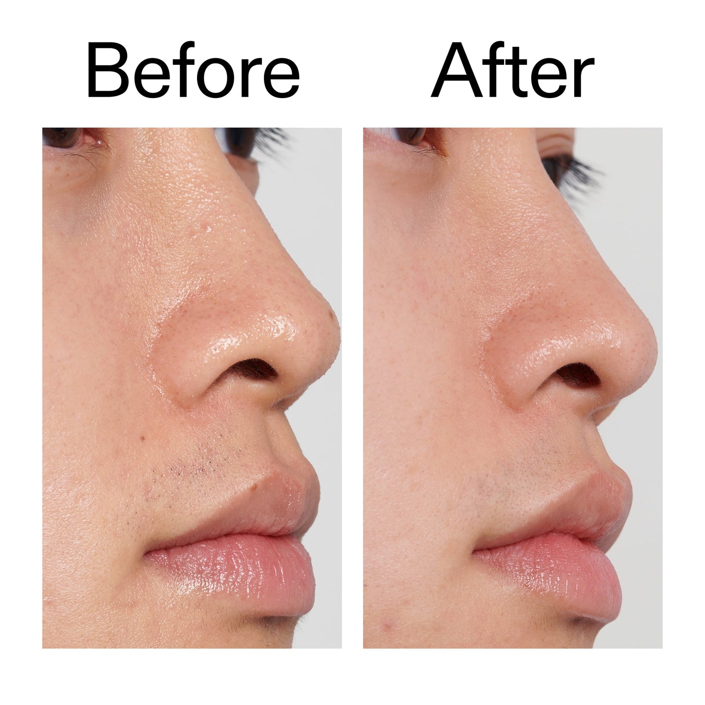 pha-toner-i6 PHA_Toner_Before_After_2000x2000_e3c10172-0150-4342-8b95-57417eaff50d.jpg