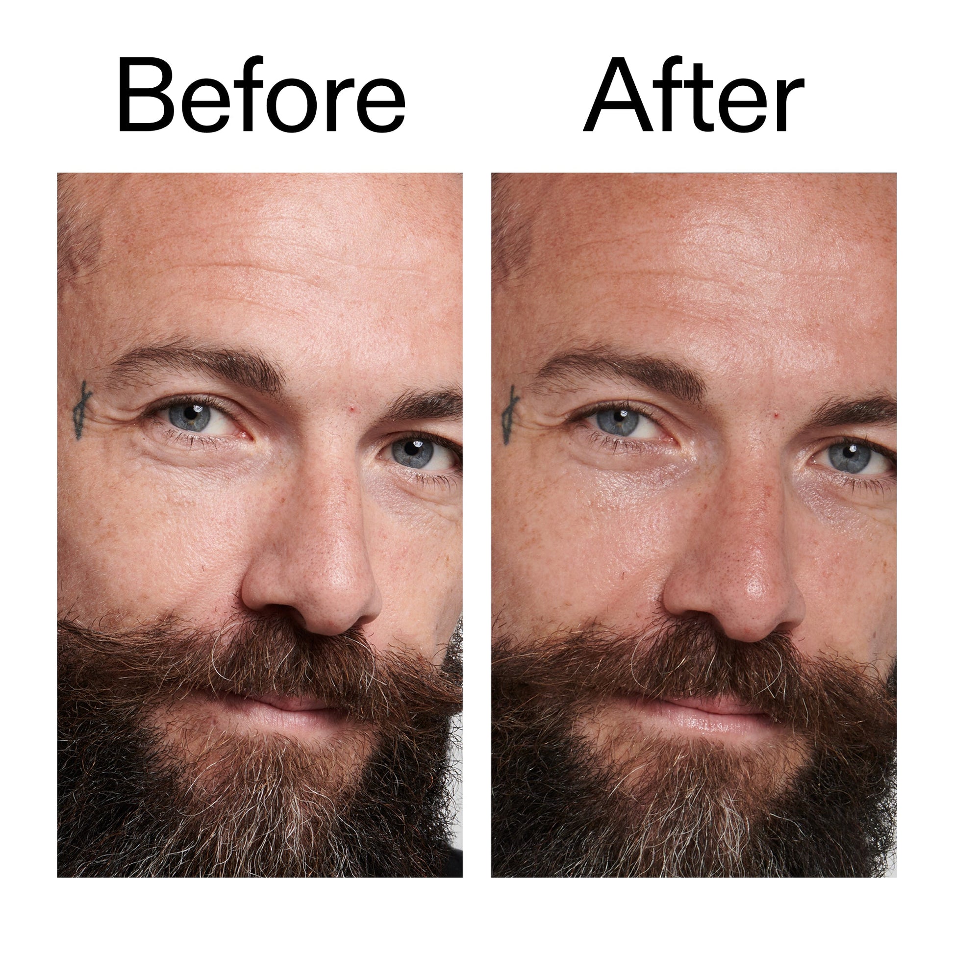 peptide-moisturizer-e7 Peptide_Moisturizer_Before_After_2000x2000_84623fe4-7b72-4f89-8e87-5edb6c752ac5.jpg