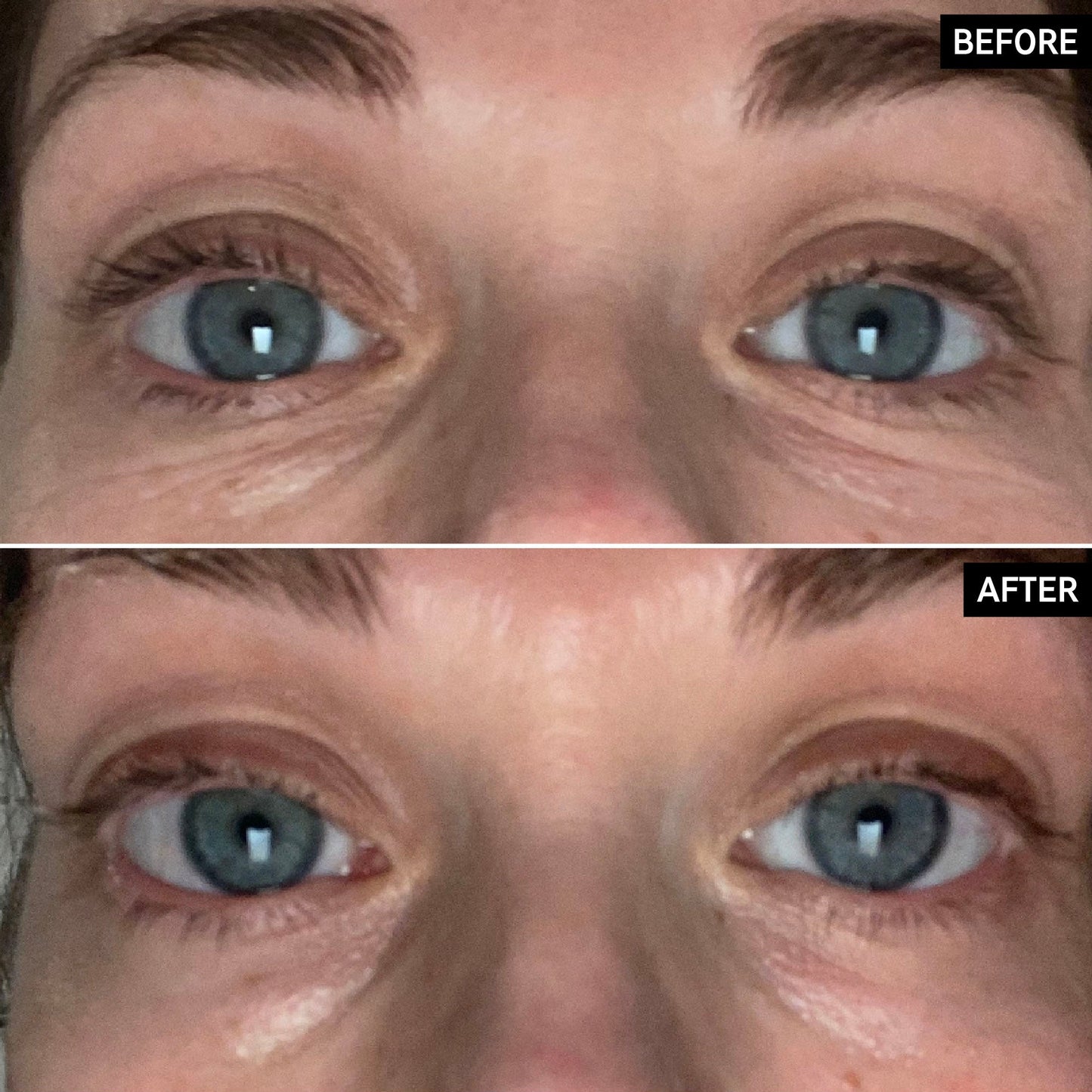 retinol-eye-cream-a3 SITE-UGCBAsApril_Nicole_B_A_PPage_2000x2000_1.jpg