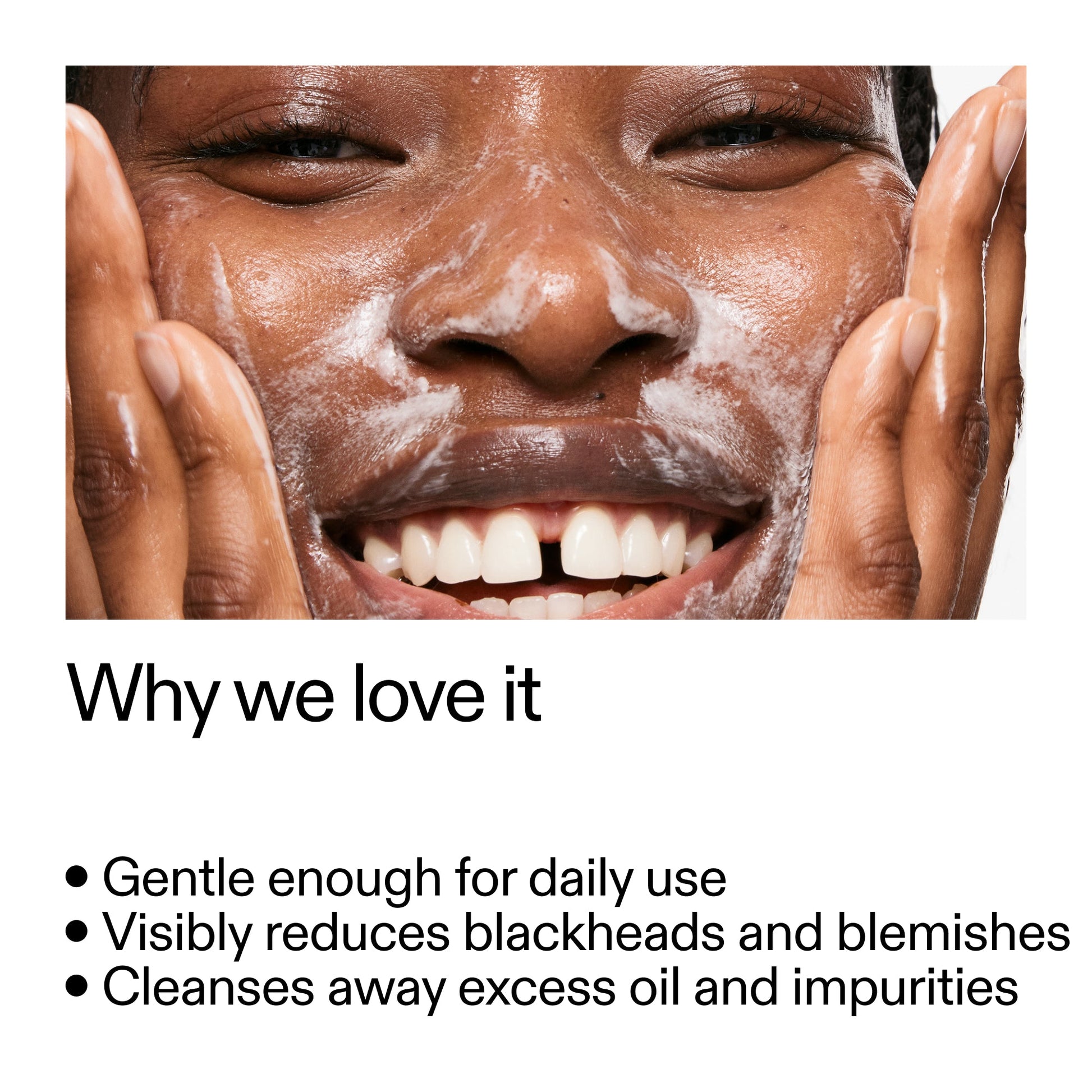 salicylic-acid-cleanser-150ml-o3 Salicylic_Acid_Cleanser_-_300mlWhy_we_love_it_2000x2000_87dc92a9-2559-4309-98cd-4e570f1be735.jpg