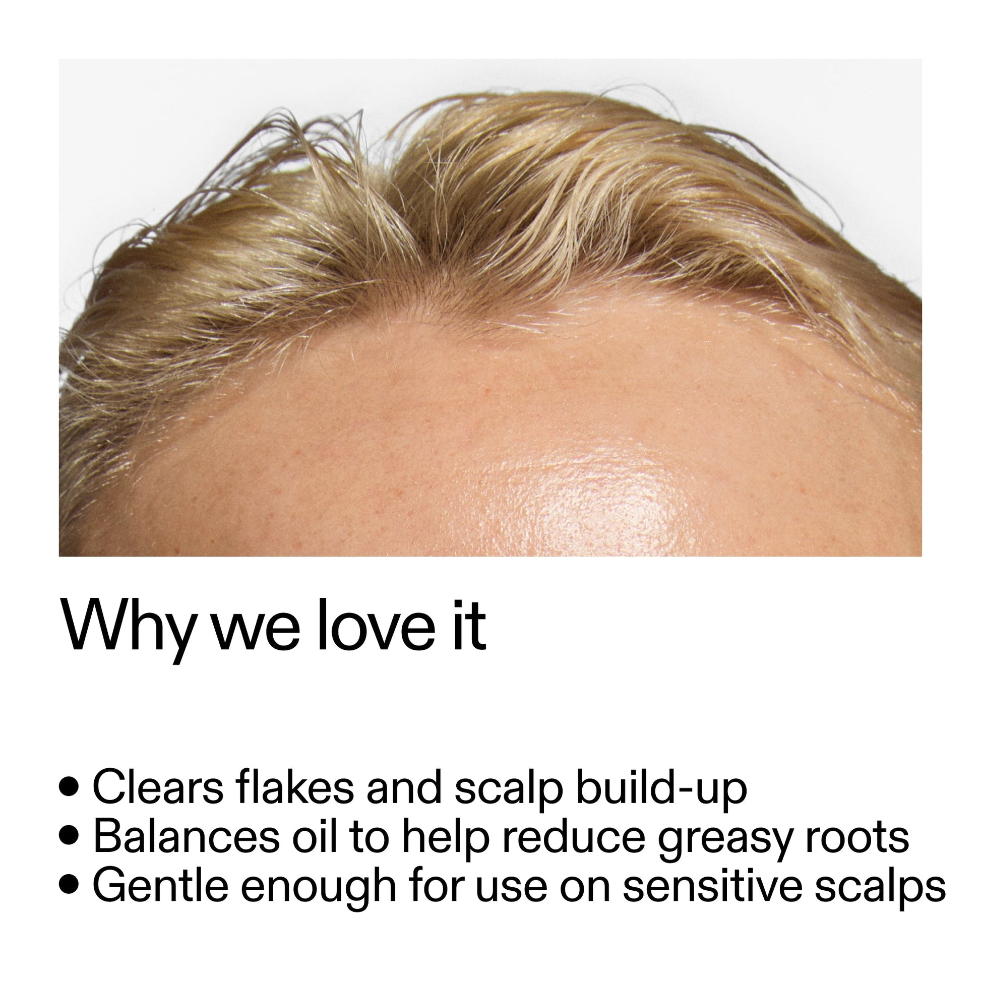 salicylic-acid-exfoliating-scalp-treatment-x8 Salicylic_Acid_Exfoliating_Scalp_Treatment_Why_we_love_it_2000x2000_44b6bd6d-9ec4-4b23-9dc4-bc3fd6f28e14.jpg