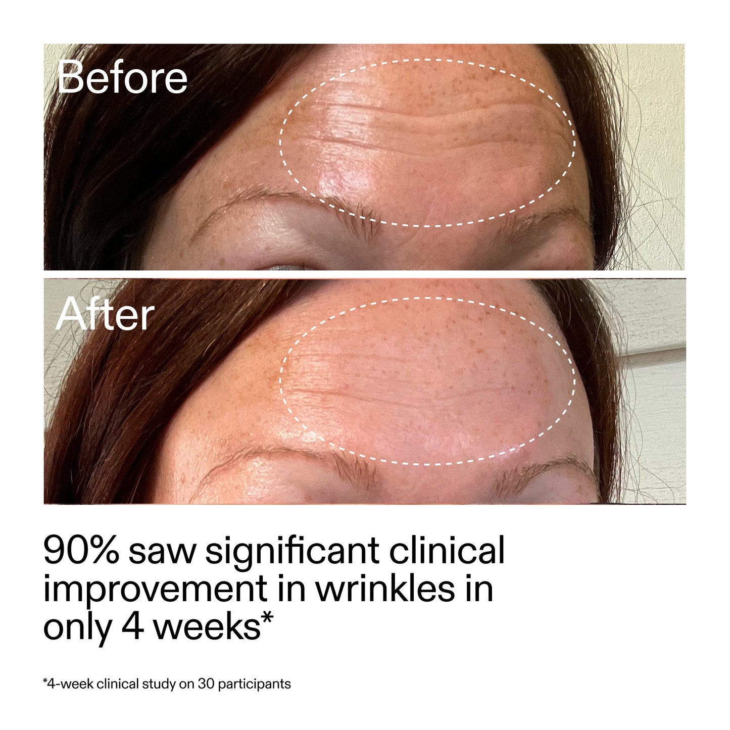 starter-retinol-serum-t0 StarterRetinol_BeforeAfter_Claim1_2000x2000_a09b50b6-4688-4527-abae-21bd142b89b7.jpg