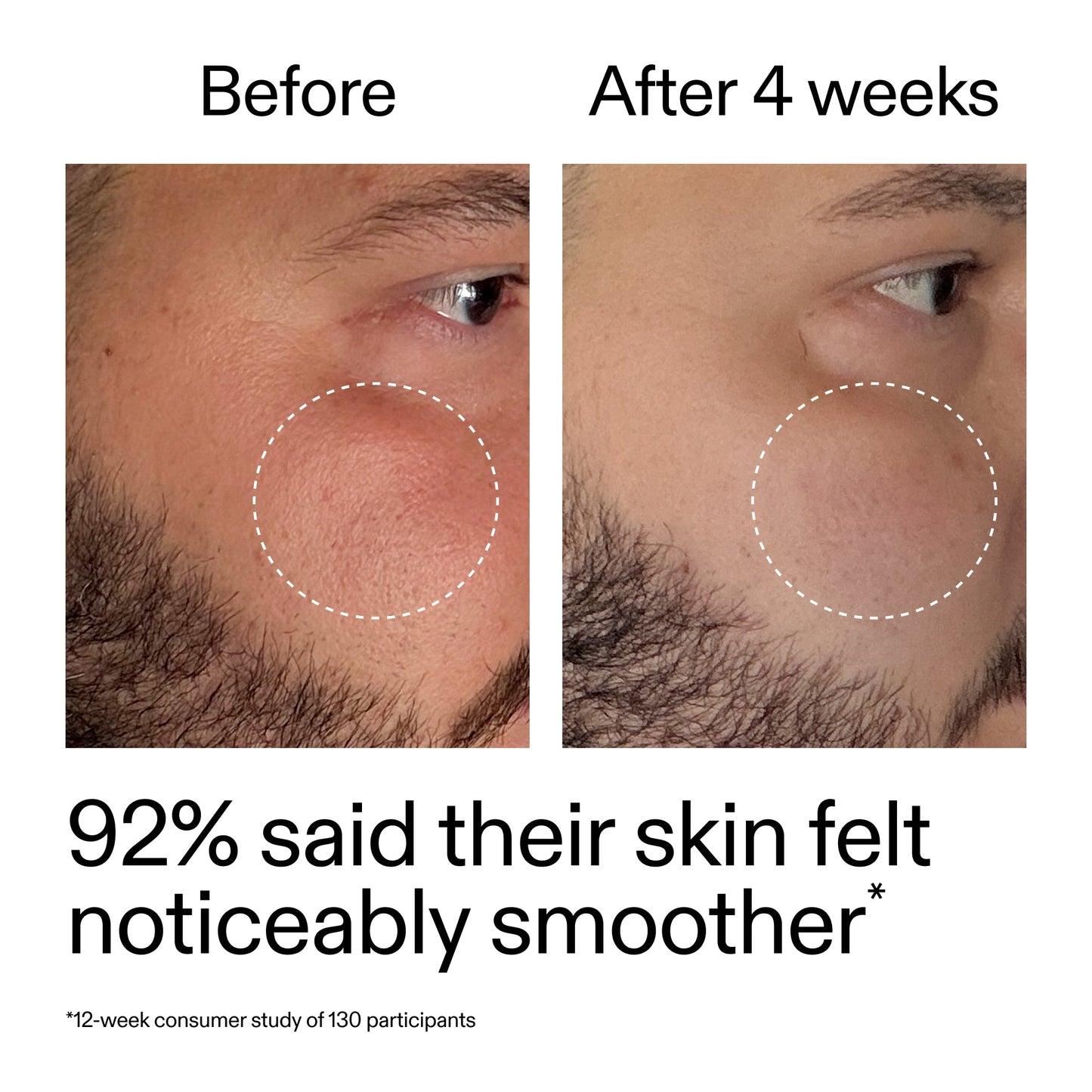 starter-retinol-serum-t0 StarterRetinol_BeforeAfter_Claim3_2000x2000_6ceab106-e0ee-4ed4-ba62-41bc39538038.jpg