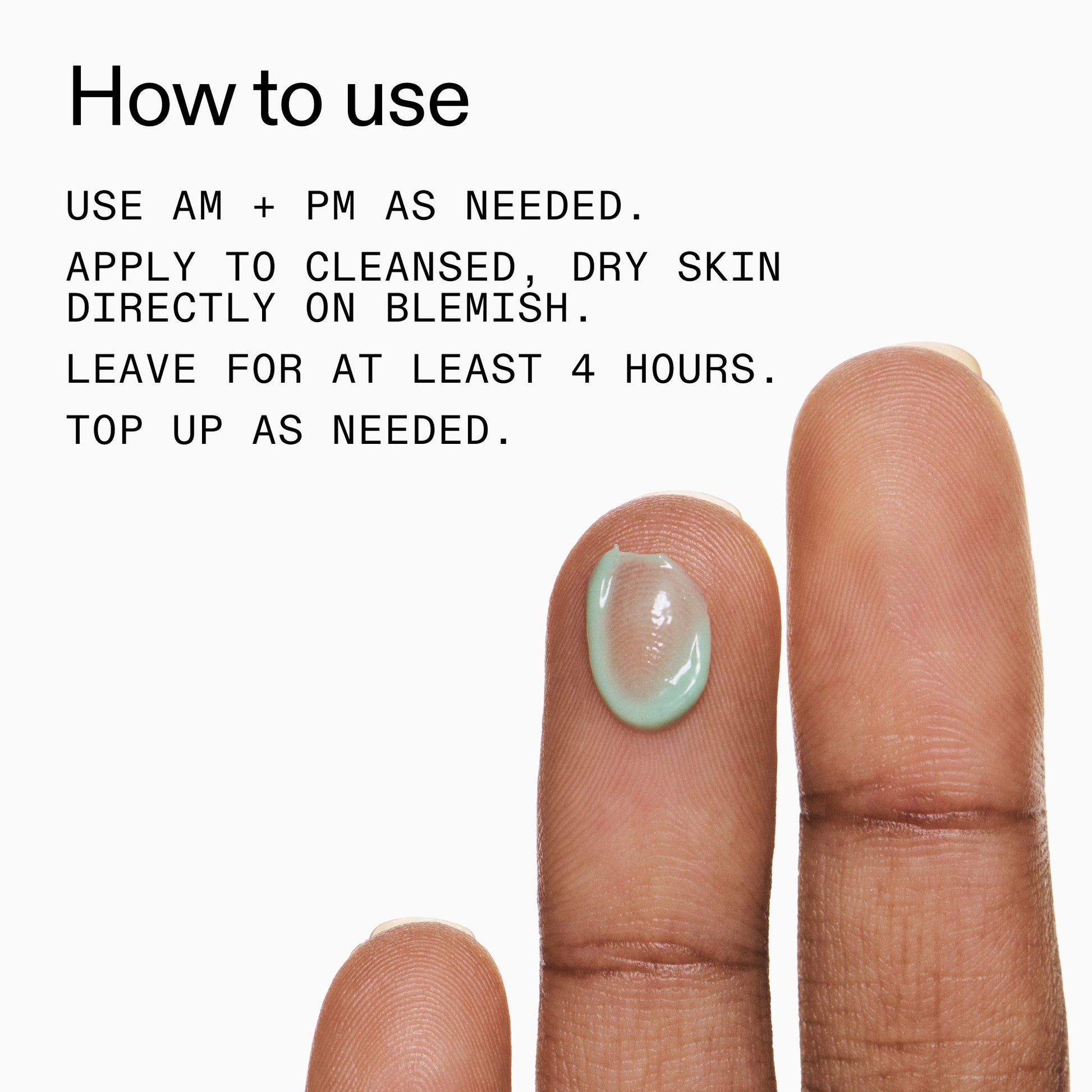succinic-acid-acne-treatment-u9 Succinic_Acid_Treatment_How_to_Use_2000x2000_d57137d5-d7f1-427c-9a46-5fc00c19c542.jpg